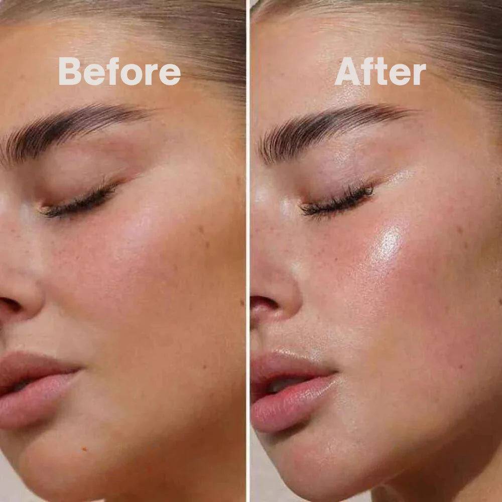 Before and after skin transformation showcasing the effectiveness of Vithora Anti-Aging Overnight Bio Collagen Face Mask